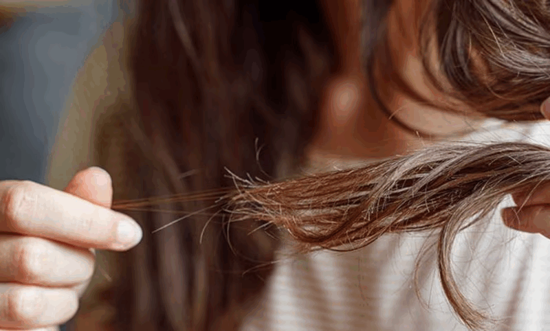 موخوره: علل، نشانه‌ها و روش‌های درمان آن